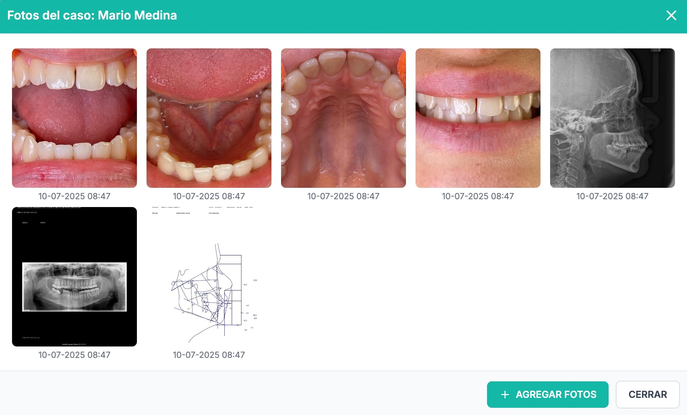 Algoritmo de compresión de imágenes y videos
